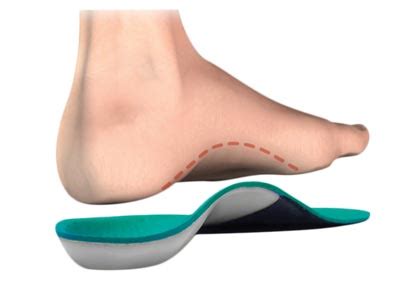 Semelle Orthopédique Lille